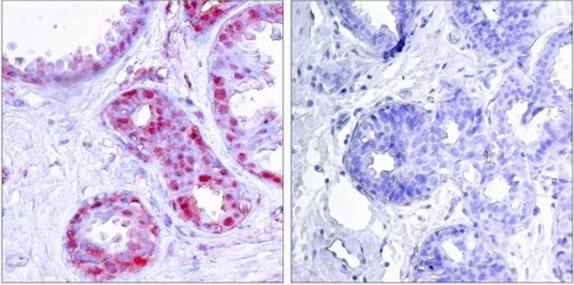 c-Jun (Phospho-Ser243) Antibody