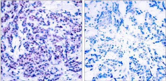 JunD (Phospho-Ser255) Antibody