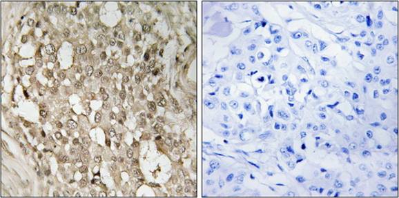 NF-κB p65 (Phospho-Ser529) Antibody