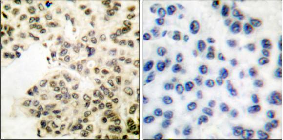 NF-κB p65 (Phospho-Ser311) Antibody