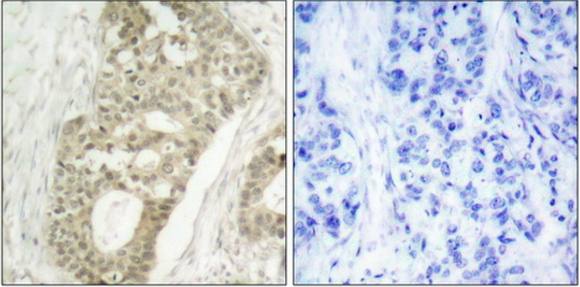 PKC δ (Phospho-Ser645) Antibody