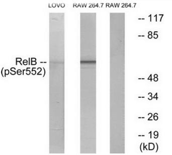 RelB (Phospho-Ser573) Antibody