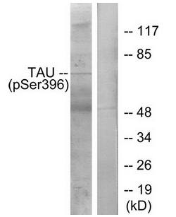 Tau (Phospho-Ser396) Antibody