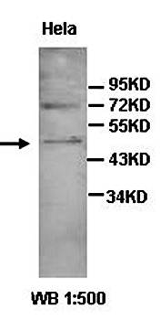 AADACL3 Rabbit Polyclonal Antibody