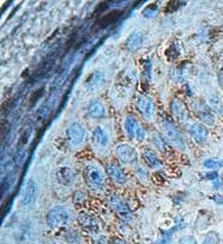 AADACL3 Rabbit Polyclonal Antibody