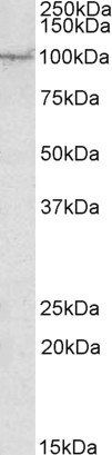 AAK1 Antibody