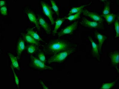 AARS Antibody