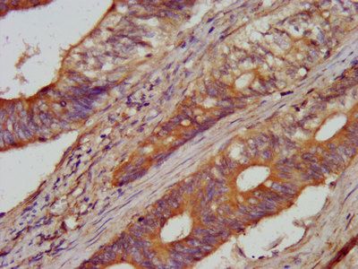 AARS Antibody