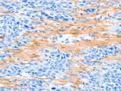 AARS Antibody