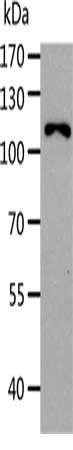 AARS Antibody