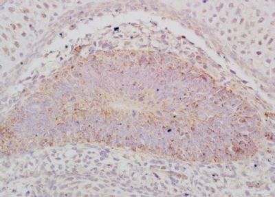 ABCA12 Rabbit Polyclonal Antibody