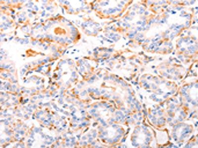 ABCA4 Antibody