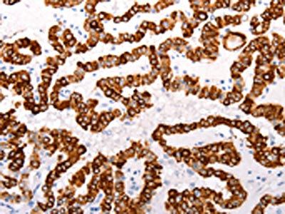 ABCA4 Antibody