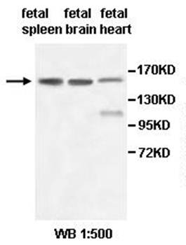ABCC10 Rabbit Polyclonal Antibody