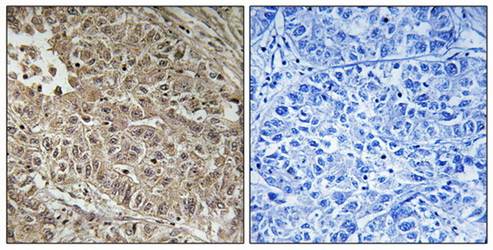 ABCC13 Antibody