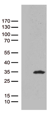 ABCD2 Antibody