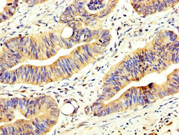 ABCD2 Antibody
