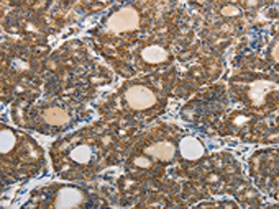 ABCD2 Antibody