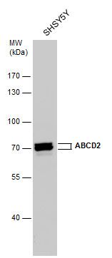 alpha amylase 2A (pancreatic) antibody [N2C3]
