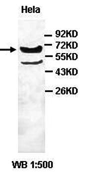 ABCD3 Rabbit Polyclonal Antibody