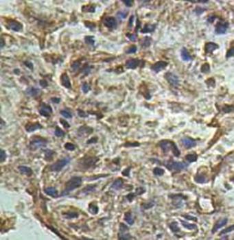 ABCG1 Rabbit Polyclonal Antibody