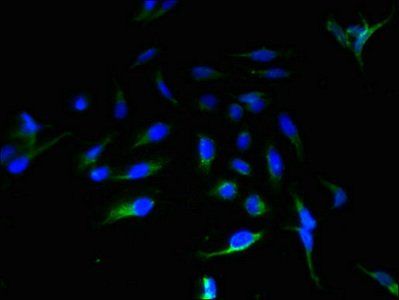 ABHD14A Antibody