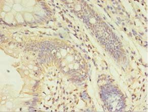 ABHD14A Antibody