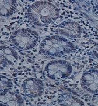 ABHD4 Rabbit Polyclonal Antibody