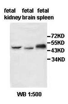ABHD4 Rabbit Polyclonal Antibody