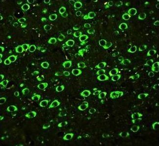 SSH3BP1/ABI1 Rabbit Polyclonal Antibody