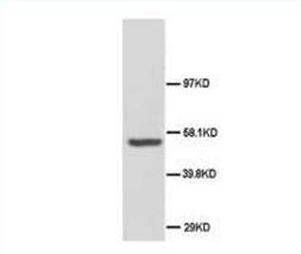 SSH3BP1/ABI1 Rabbit Polyclonal Antibody