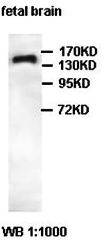 ABI3BP Rabbit Polyclonal Antibody