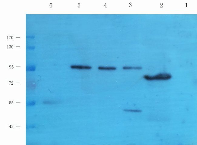 ABL2 Rabbit Polyclonal Antibody