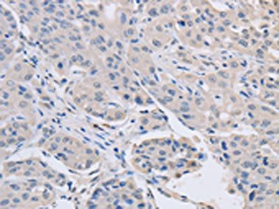 ABLIM1 Antibody