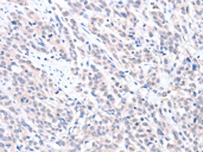 ABLIM1 Antibody