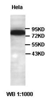 ABLIM1 Rabbit Polyclonal Antibody
