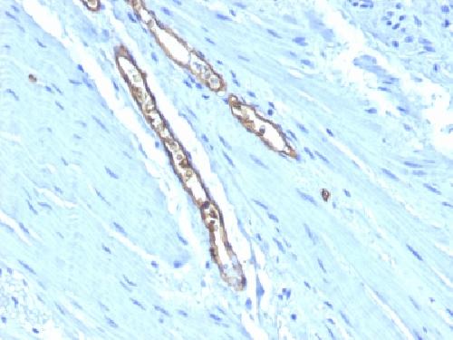 ABO Antibody