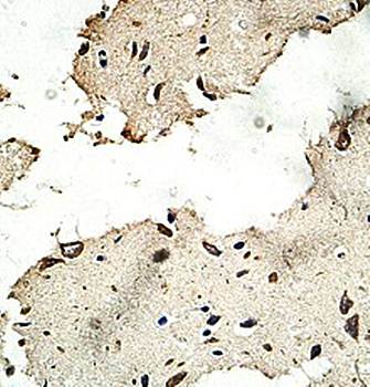 ABT1 Rabbit Polyclonal Antibody