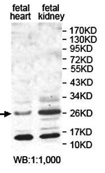 ABT1 Rabbit Polyclonal Antibody