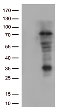 ACAD9 Antibody