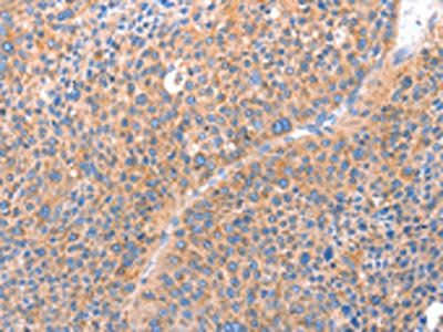 ACADS Antibody