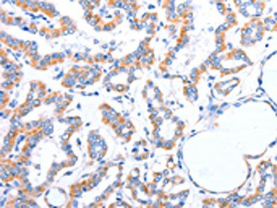 ACADS Antibody