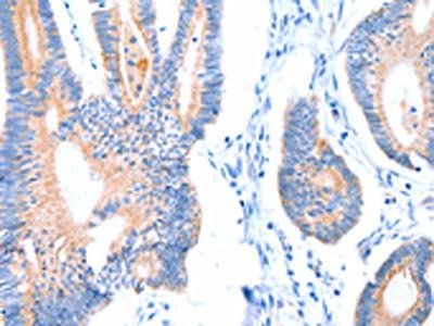 ACADS Antibody