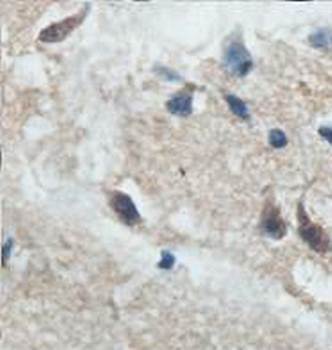 ACADS Rabbit Polyclonal Antibody