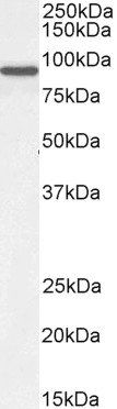 CENTB2/ACAP2 Antibody
