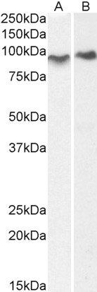 CENTB2/ACAP2 Antibody