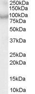 CENTB2/ACAP2 Antibody