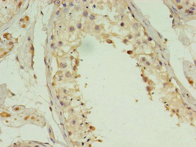 ACBD4 Antibody