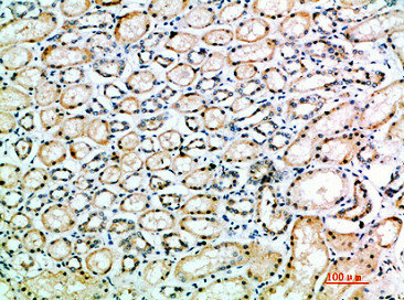 ACE Antibody