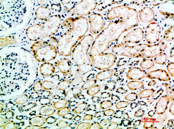 ACE Antibody